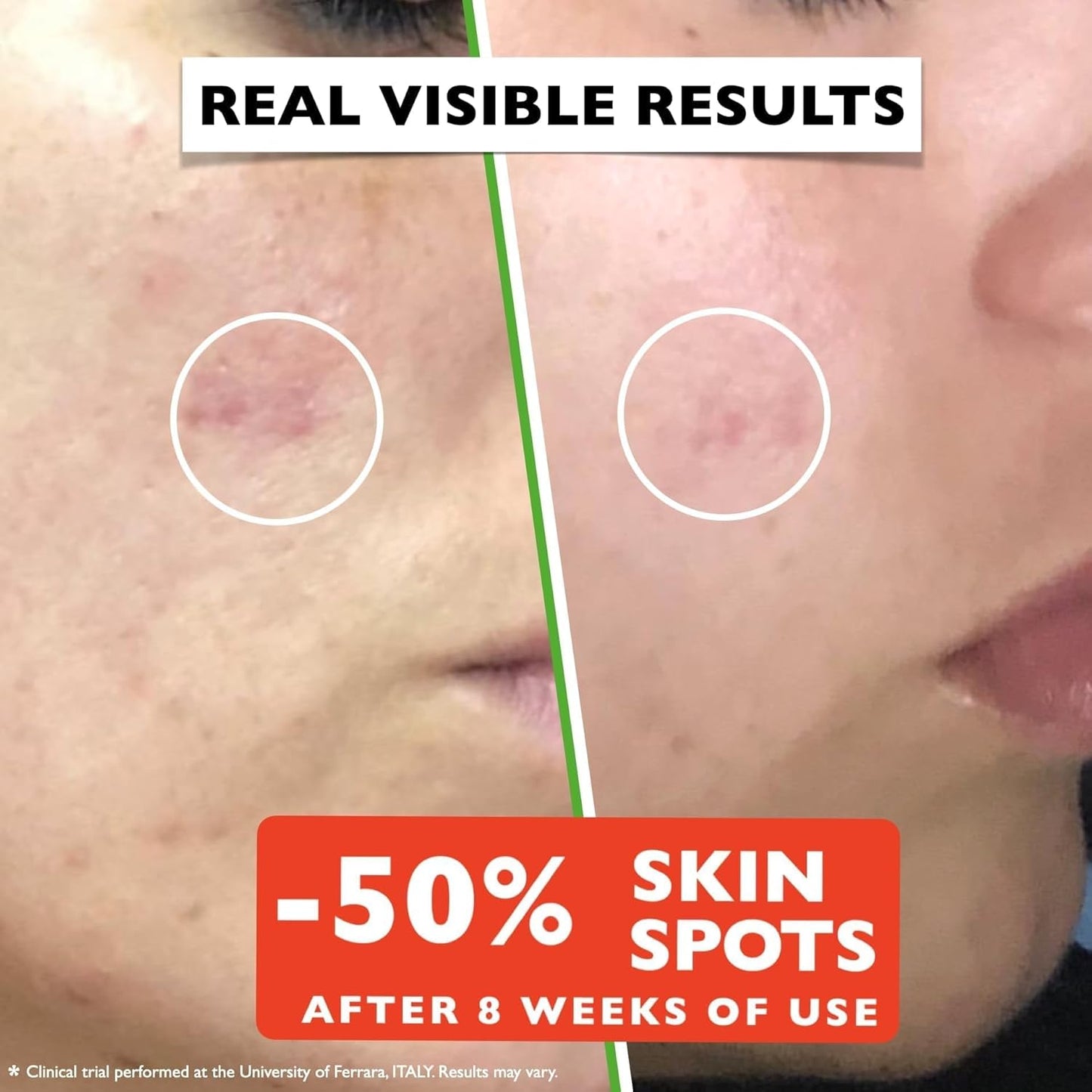 Vitamin C Serum for Face β Anti-Aging Facial Serum with Vitamin C, Hyaluronic Acid, Niacinamide, B5 & Vit E. Brightening Facial Essence for Dark Spots, Fine Lines, Wrinkles & Glowing Skin, 2 Fl Oz